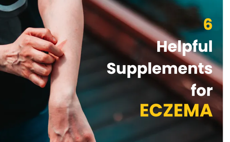 6 HELPFUL SUPPLEMENTS OF ECZEMA