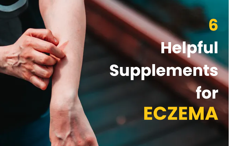 6 HELPFUL SUPPLEMENTS OF ECZEMA