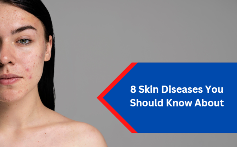 8 Skin Diseases You Should Know About