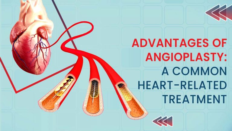 Advantages of Angioplasty: A Common Heart-related Treatment