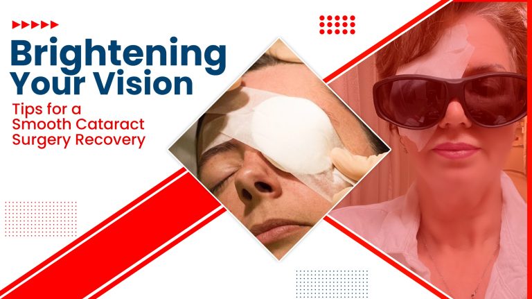 Brightening Your Vision: Tips for a Smooth Cataract Surgery Recovery