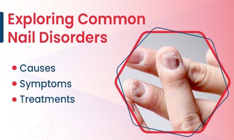Exploring Common Nail Disorders: Causes, Symptoms, and Treatments
